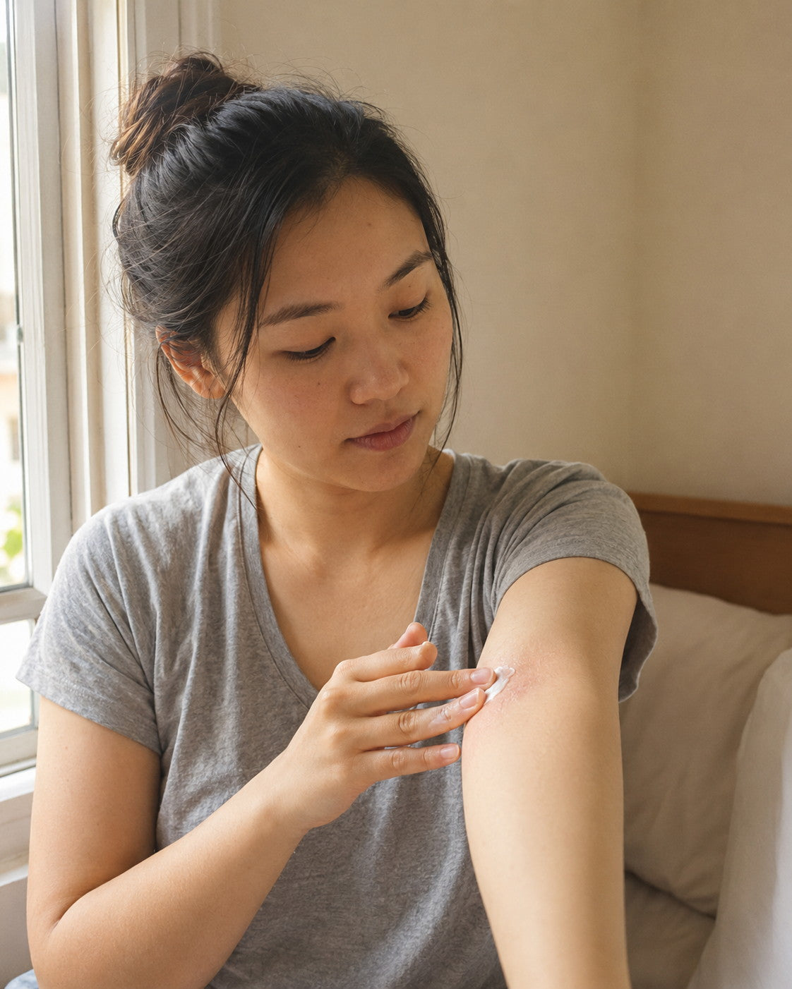 A woman sitting by a window, smoothing a little BEEUL Ease Me Cream over a red, irritated patch on her upper arm